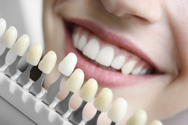 虫歯や歯周病の予防にもおすすめなポリリン酸ホワイトニングを取り扱っています。